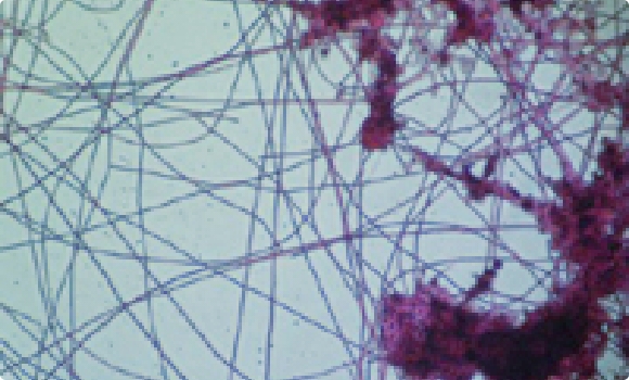糸状菌染色